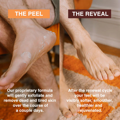 Exfoliating Foot Mask